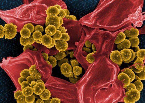 Humanmicrobes